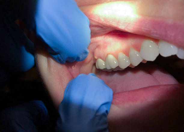 Best Orthodontic Emergency Dentist in Pendleton, SC